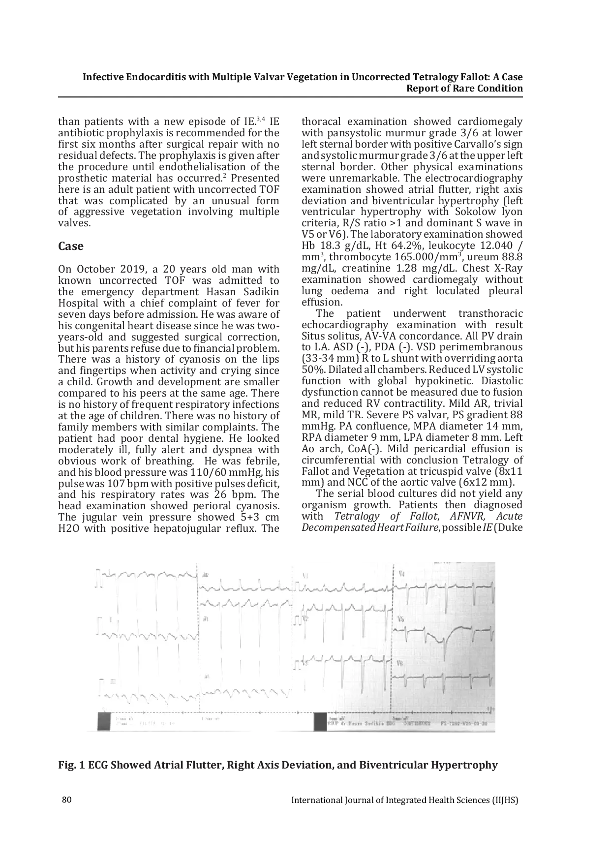 JURIS Infective Endocarditis with Multiple Valvar Vegetation in Uncorrected Tetralogy Fallot A Case Report of Rare Condition