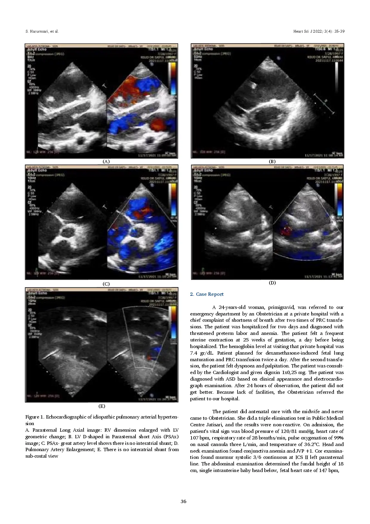 juris Idiopathic Pulmonary Arterial Hypertension Newly Diagnosed in Pregnancy with Anemia and Threatened Preterm Labor
