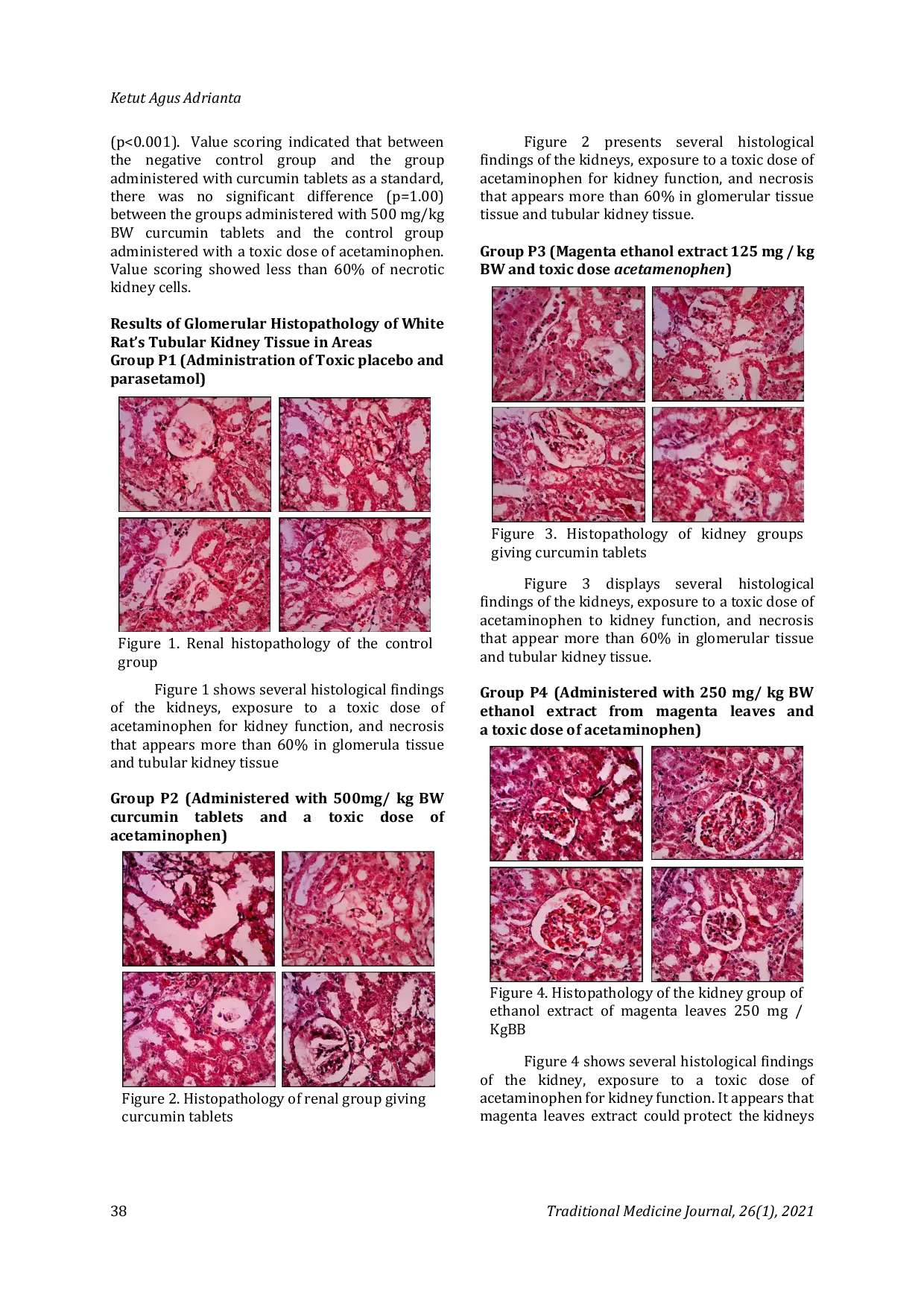 JURIS The Antioxidant Capacity of Peristrophe Bivalvis L Merr as Natural Based Nephroprotection