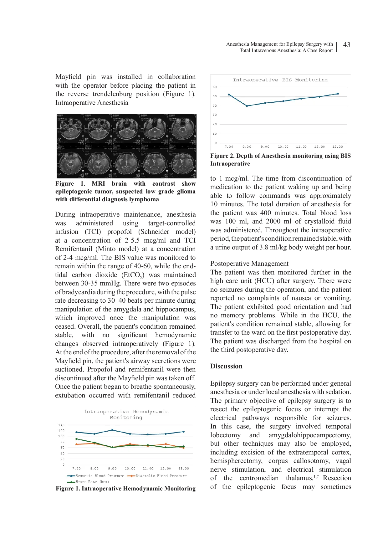 JURIS Anesthesia Management for Epilepsy Surgery with Total Intravenous Anesthesia A Case Report
