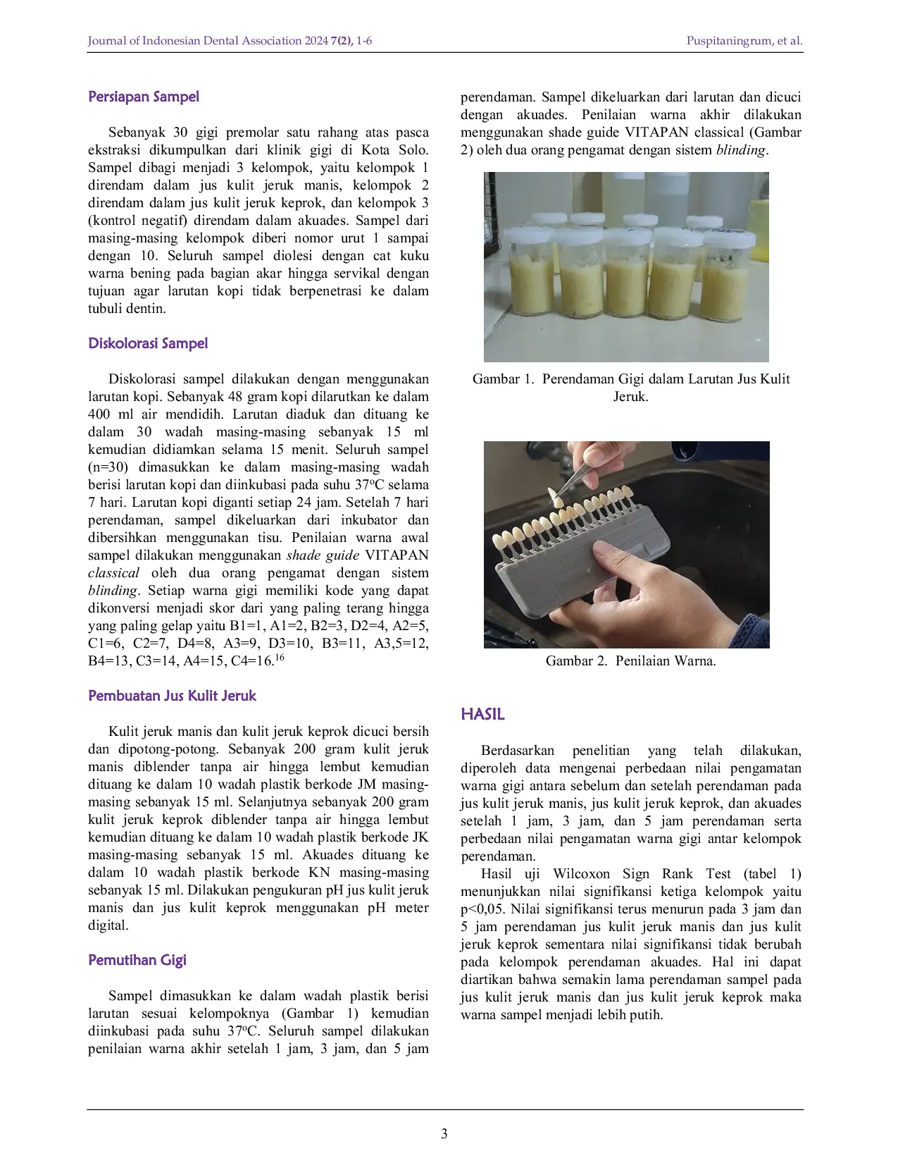 JURIS Effect of Immersion Time in Sweet Orange and Tangerine Peel Juice on Teeth Whitening In Vitro Study