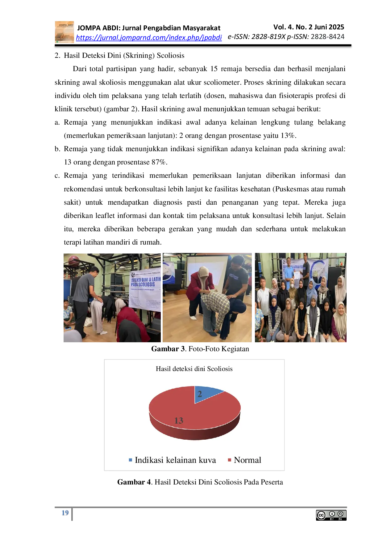 JURIS Penyuluhan dan Deteksi Dini Scoliosis Pada Remaja Di Wilayah Kelurahan Mulyorejo Surabaya