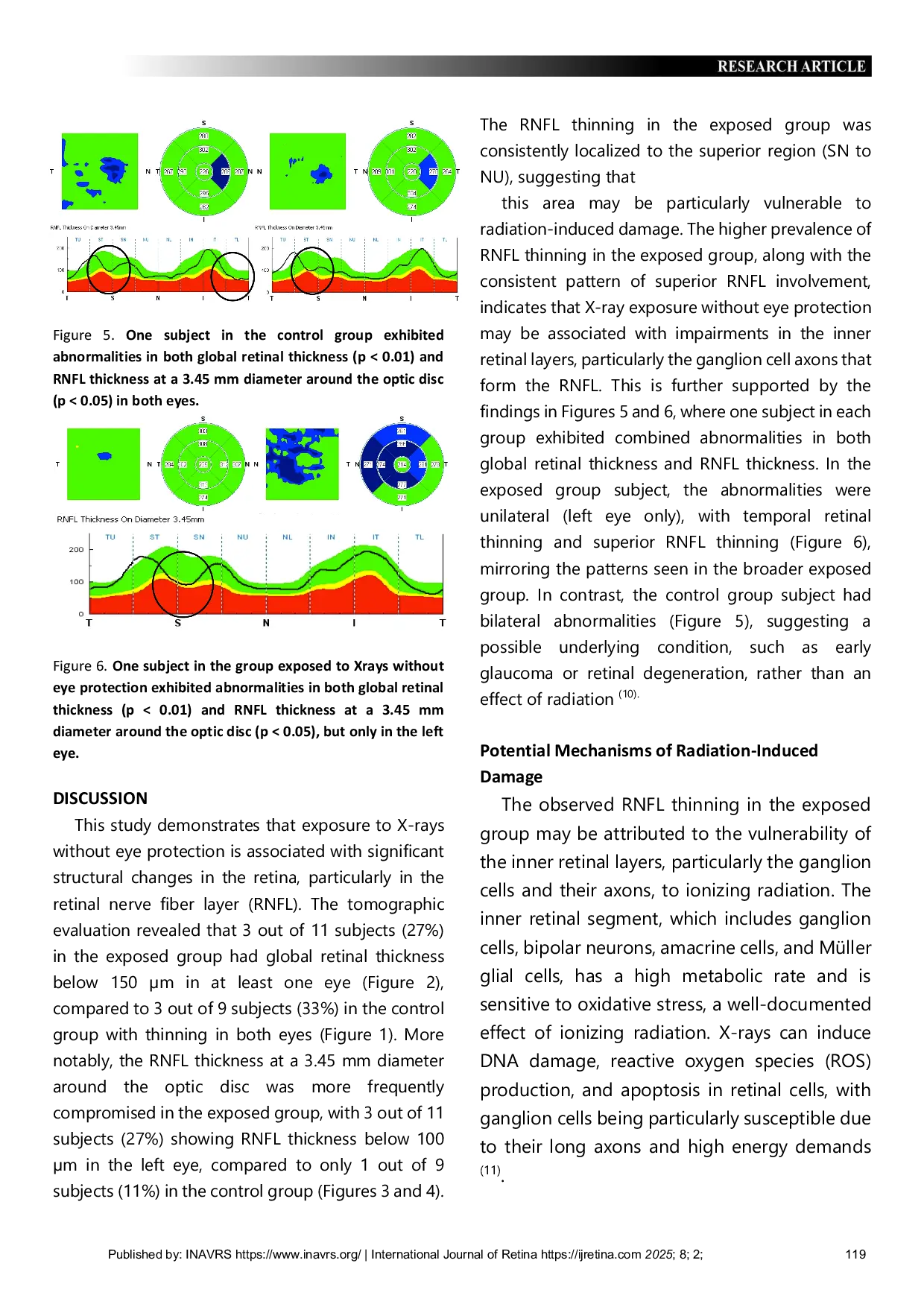 JURIS Retinal Thickness and RNFL Evaluation by OCT in Radiology Technicians Exposed to X Rays Without Eye Protection in Amazonian Clinics