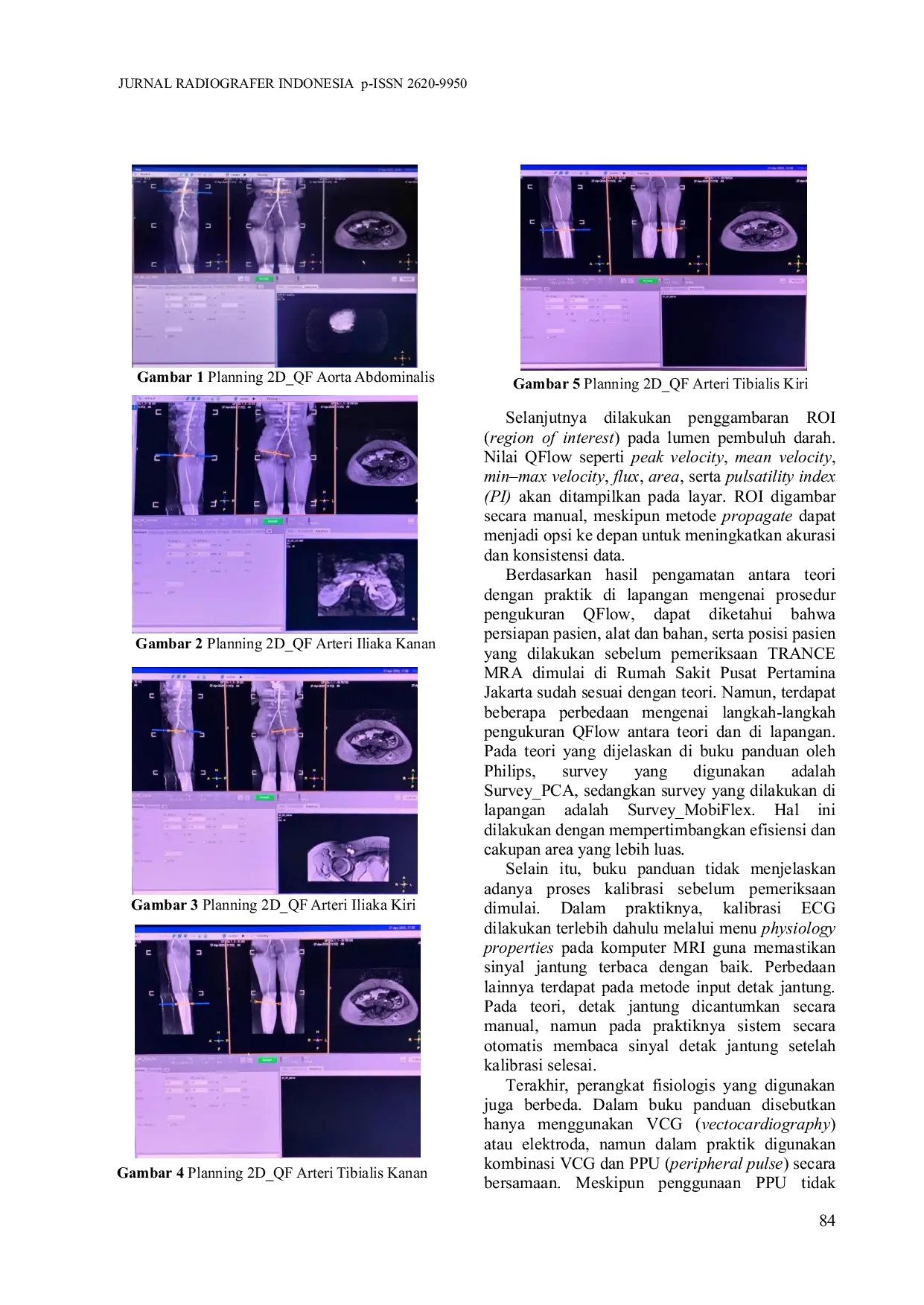 JURIS Analisis Nilai QFlow Arteri Tungkai Bawah pada Kelompok Usia 18 23 Tahun Menggunakan Pemeriksaan TRANCE MRA