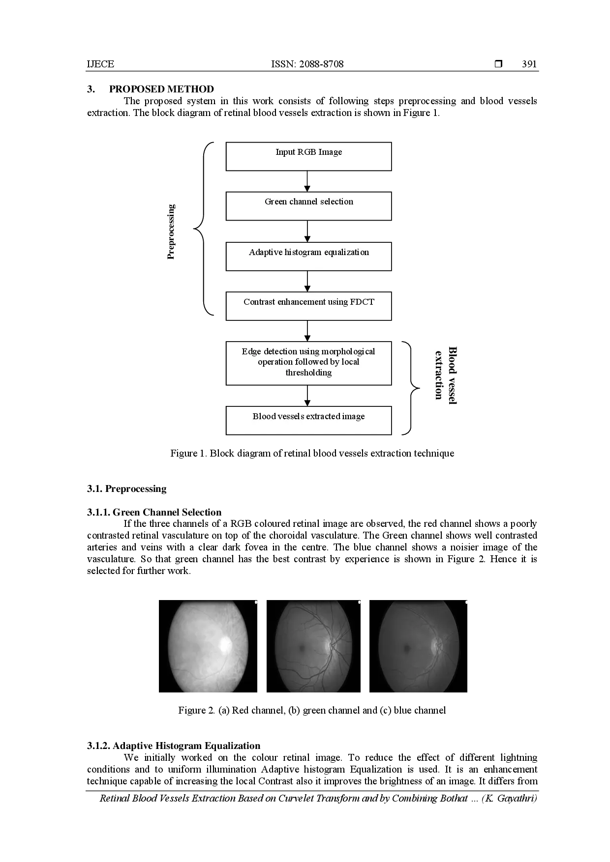 juris Retinal Blood Vessels Extraction Based on Curvelet Transform and by Combining Bothat and Tophat Morphology