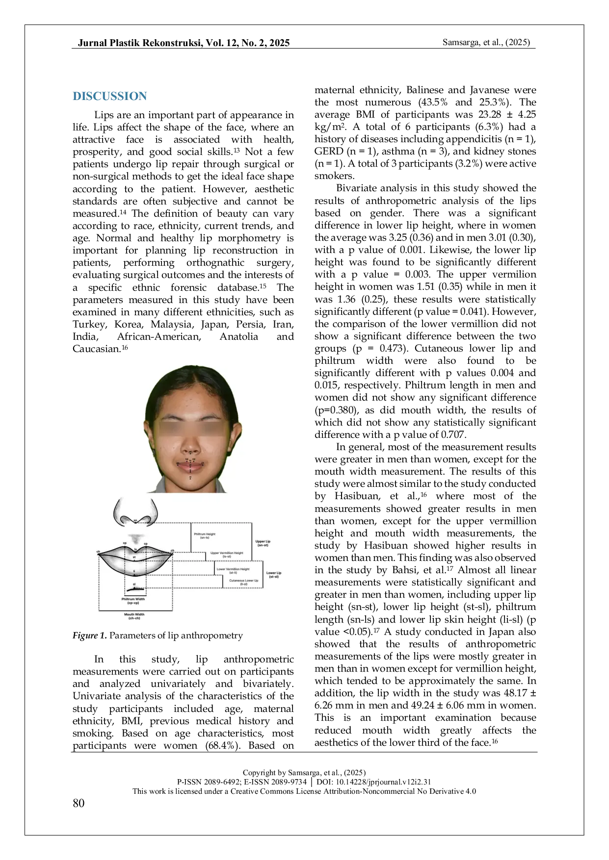 JURIS Assessing Ideal Lip Anatomy Through Photogrammetry Implications For Facial Reconstruction In Indonesia