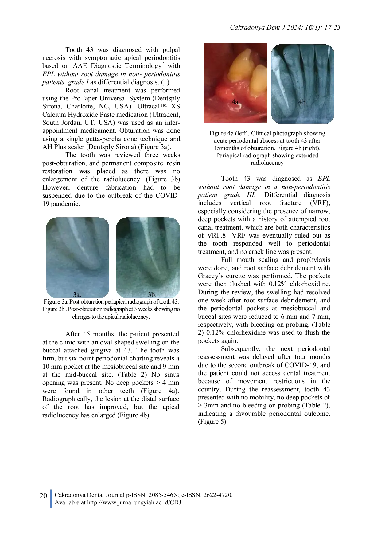 JURIS Implementing the 2017 EFP AAP Periodontal Disease Classification in The Diagnosis and Management of Endo Periodontal Lesions A Case Report