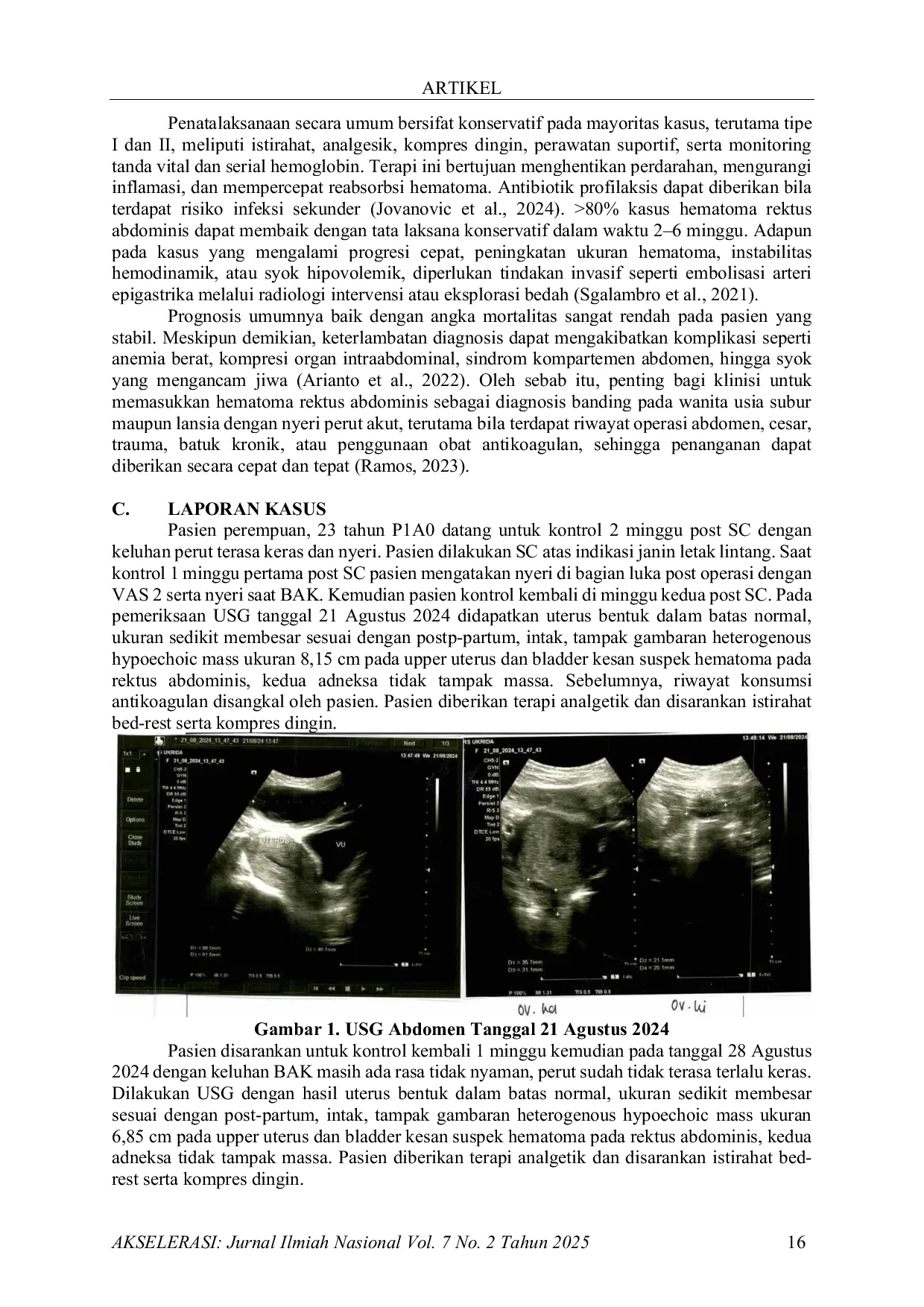 JURIS Hematoma Rektus Abdominis