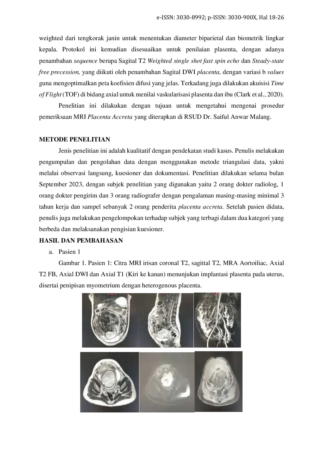 JURIS Prosedur Pemeriksaan MRI Placenta Accreta Di RSUD Dr Saiful Anwar Malang