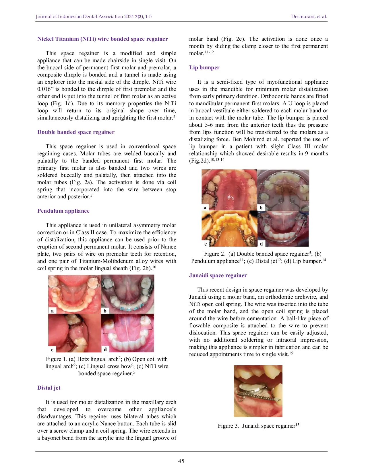 JURIS Space Regainers in Pediatric Dentistry A Review