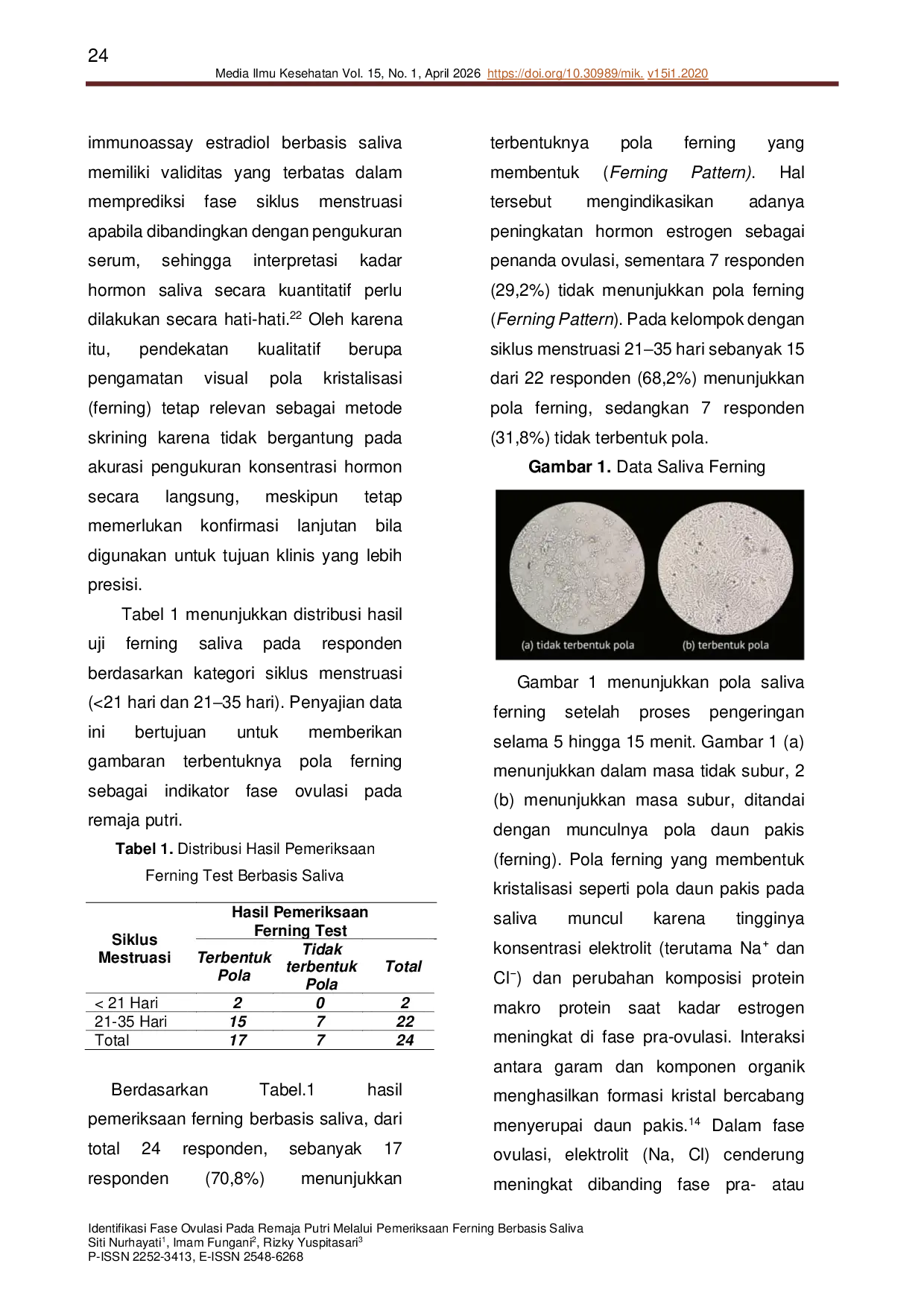 JURIS Identification of the ovulation phase in female adolescent through saliva based ferning test
