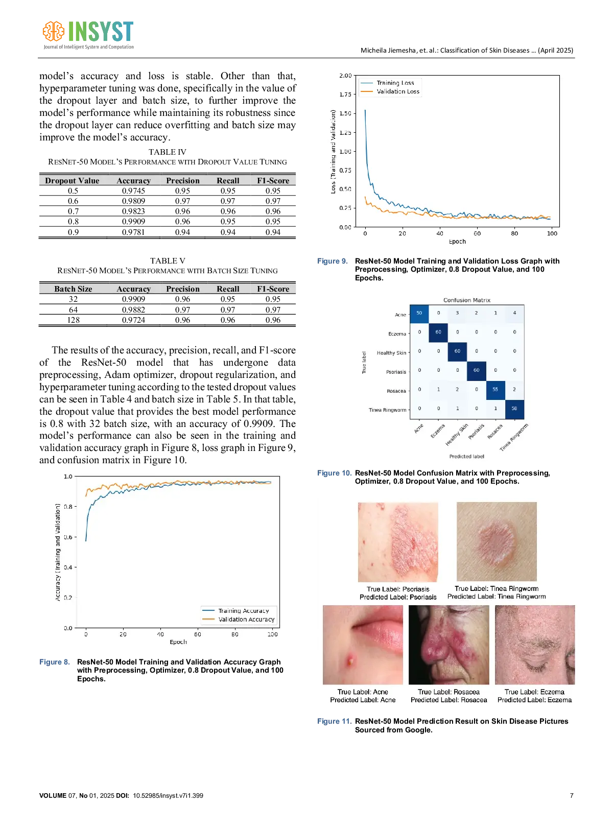 JURIS Classification of Skin Diseases Using Transfer Learning with ResNet 50 Architecture and Data Preprocessing Using Real ESRGAN and Wiener Filter
