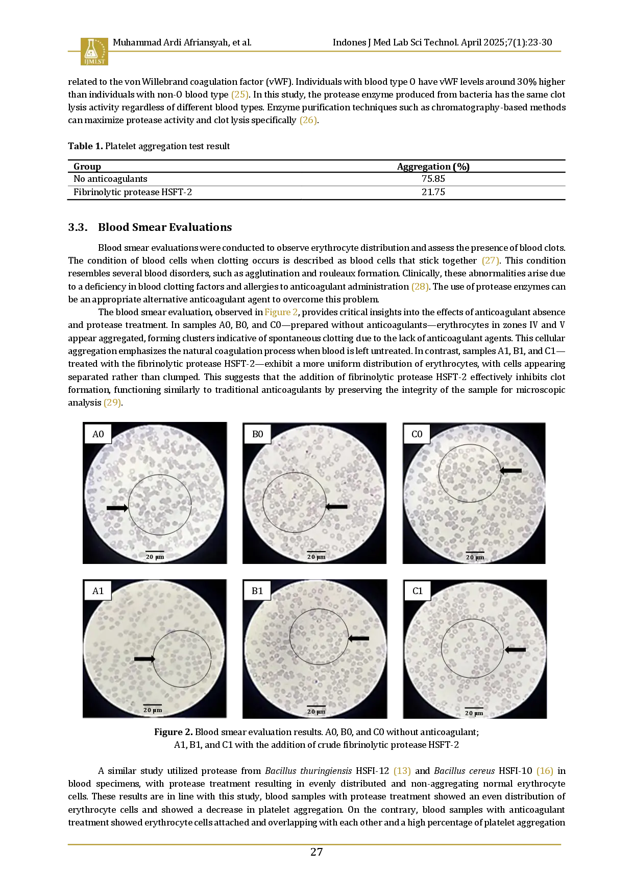 juris In vitro anticoagulant activity of crude fibrinolytic protease HSFT 2 as an alternative anticoagulant agent