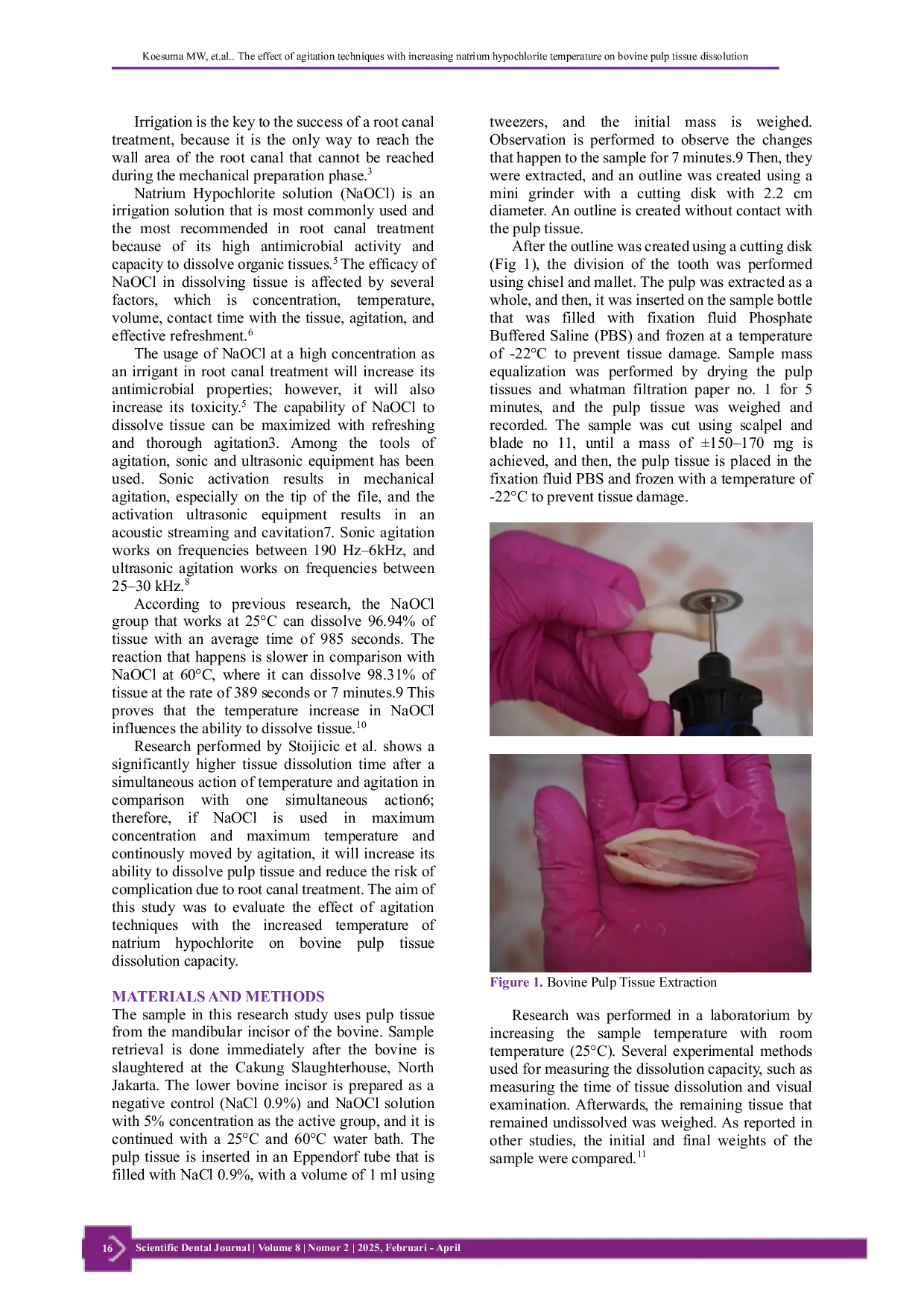 JURIS The Effect of Agitation Techniques with Increasing Natrium Hypochlorite Temperature on Bovine Pulp Tissue Dissolution