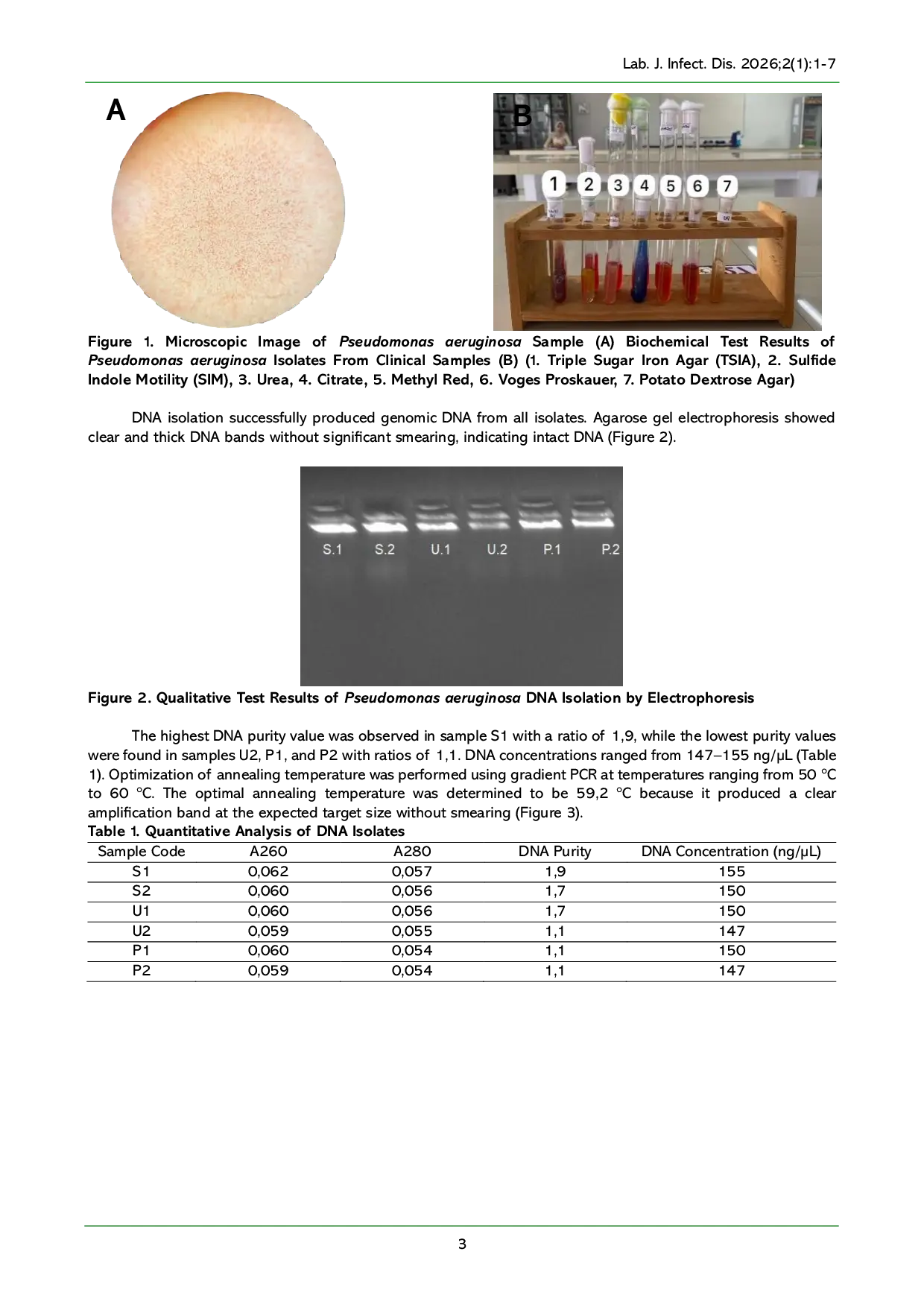 JURIS Detection of the rhlR Gene in Clinical Isolates of Pseudomonas aeruginosa Using Polymerase Chain Reaction PCR