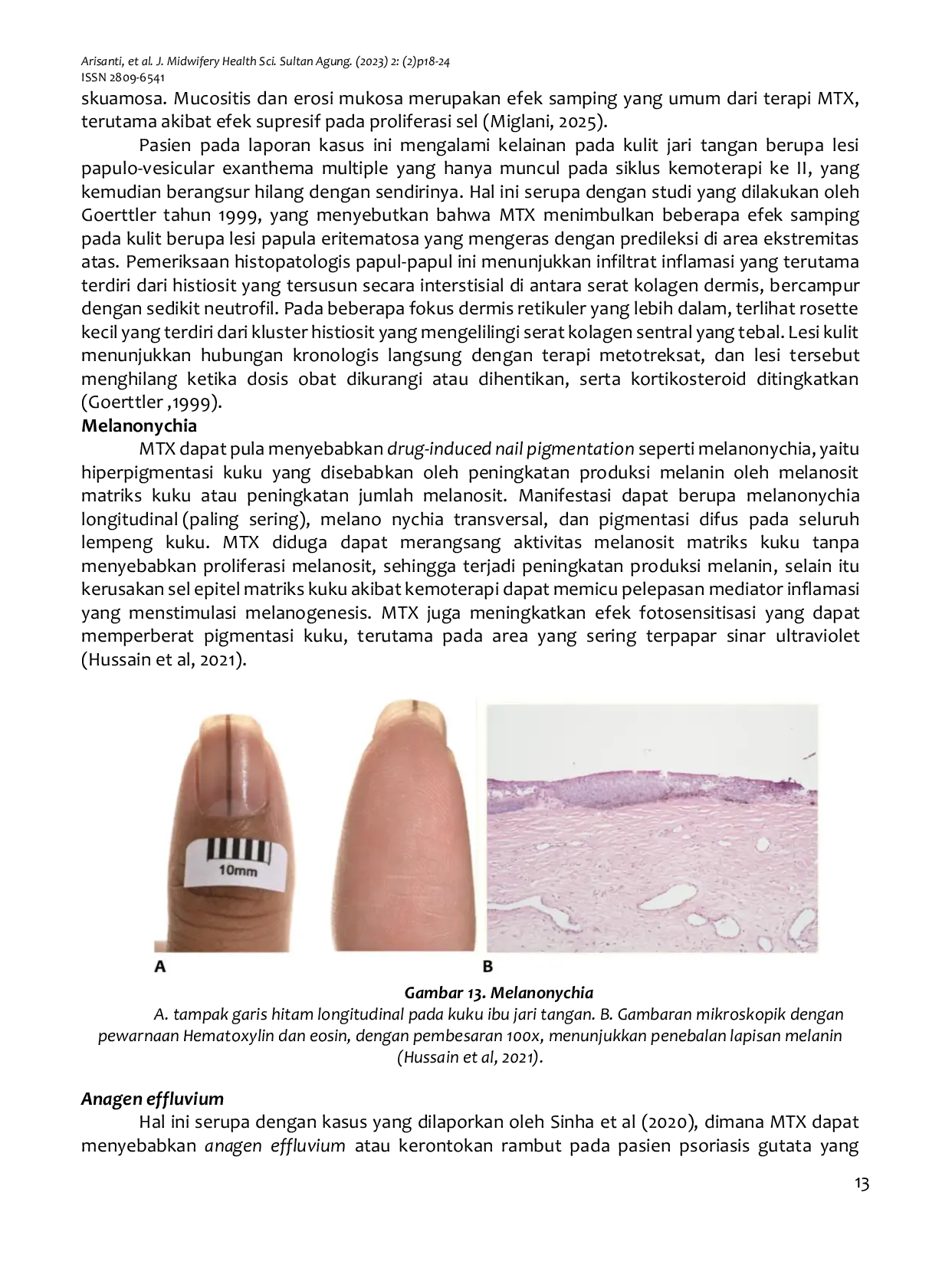 JURIS Ultrasonographic Features of Hydatidiform Mole in a 35 Year Old Woman Treated with Methotrexate Imaging Findings and Drug Induced Cutaneous Manifestations