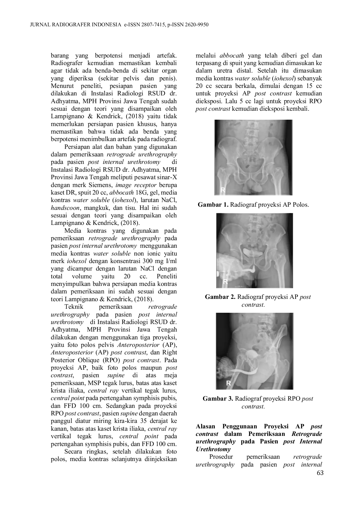 JURIS Prosedur Pemeriksaan Retrograde Urethrography pada Pasien Post Internal Urethrotomy