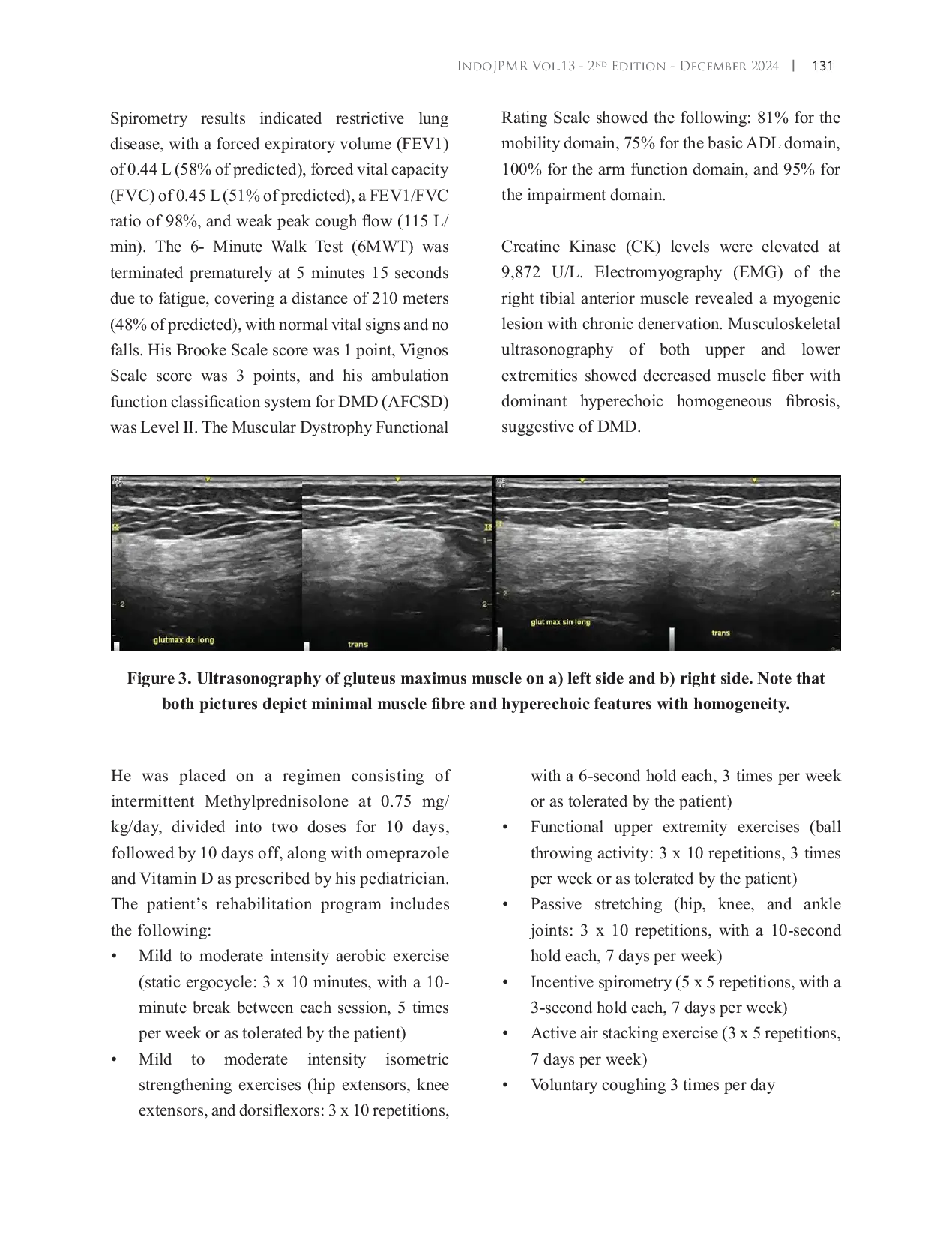 JURIS The Effect of Static Ergocycle on Cardiorespiratory Endurance in Early Ambulatory Duchenne Muscular Dystrophy Patient A Case Report