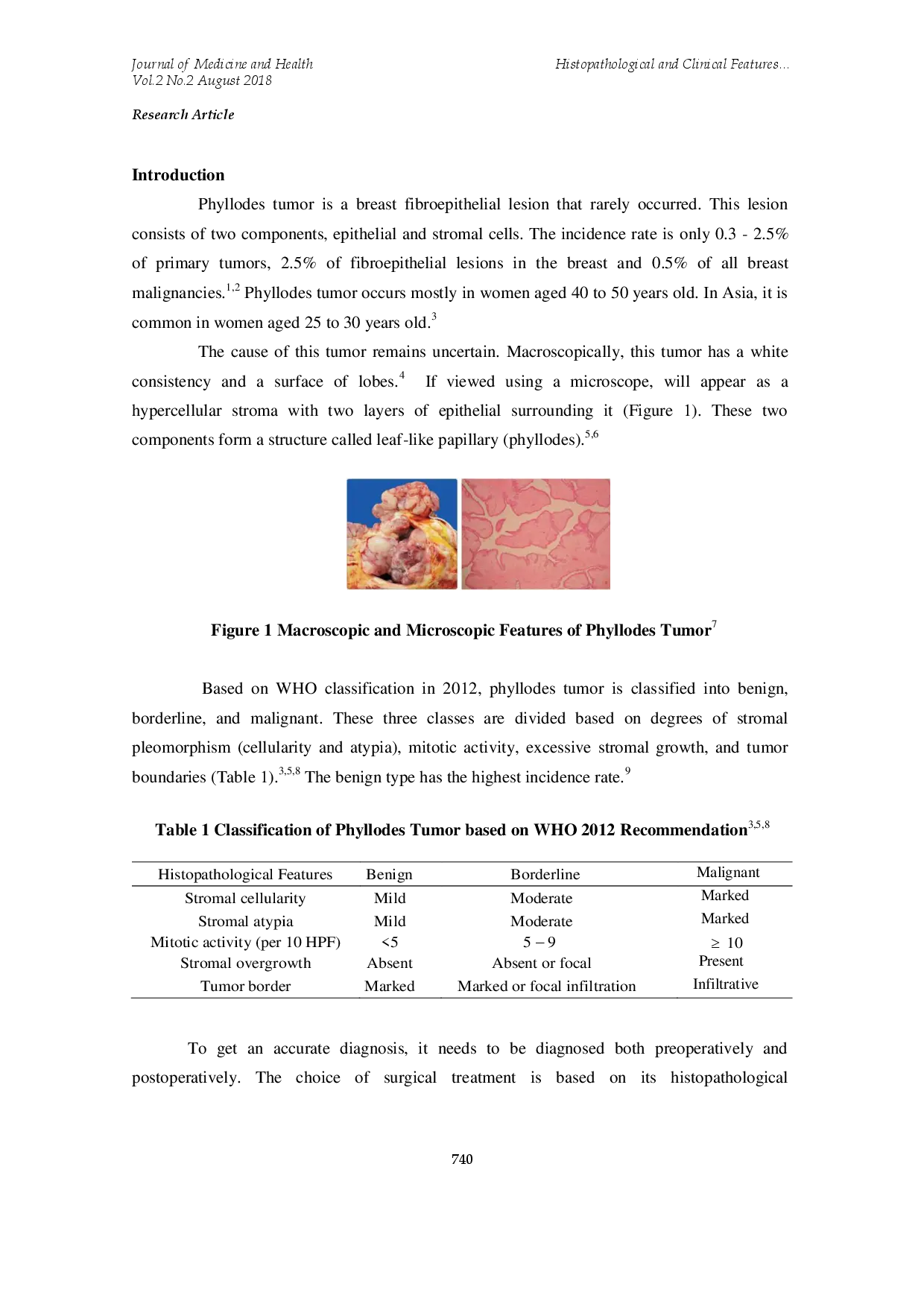 juris Histopathological and Clinical Features of Phyllodes Tumor in Hasan Sadikin during Period of 2012 2016