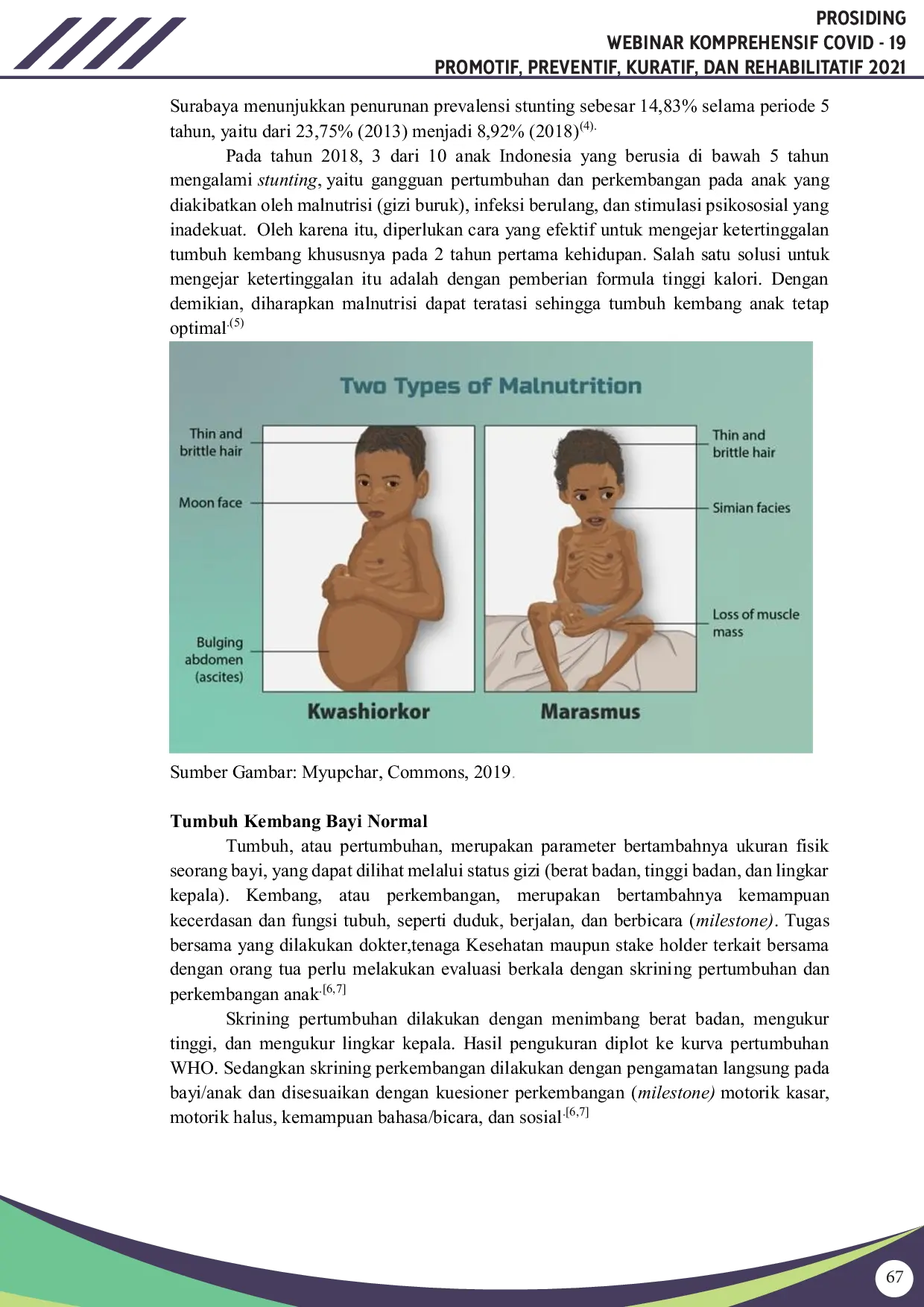 JURIS Stunting pada Anak Bawah Tiga Tahun sebagai Tanda Bahaya Red Flags dalam Masa Pandemi COVID 19